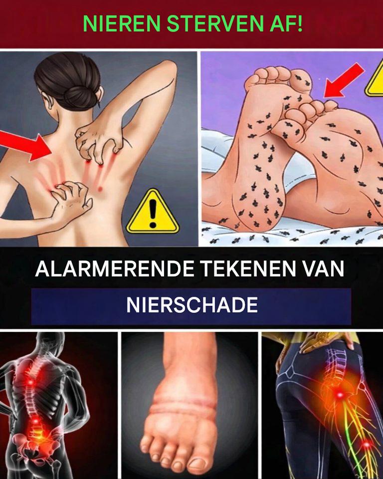 15 levensbedreigende niersymptomen die u duidelijk moet herkennen.