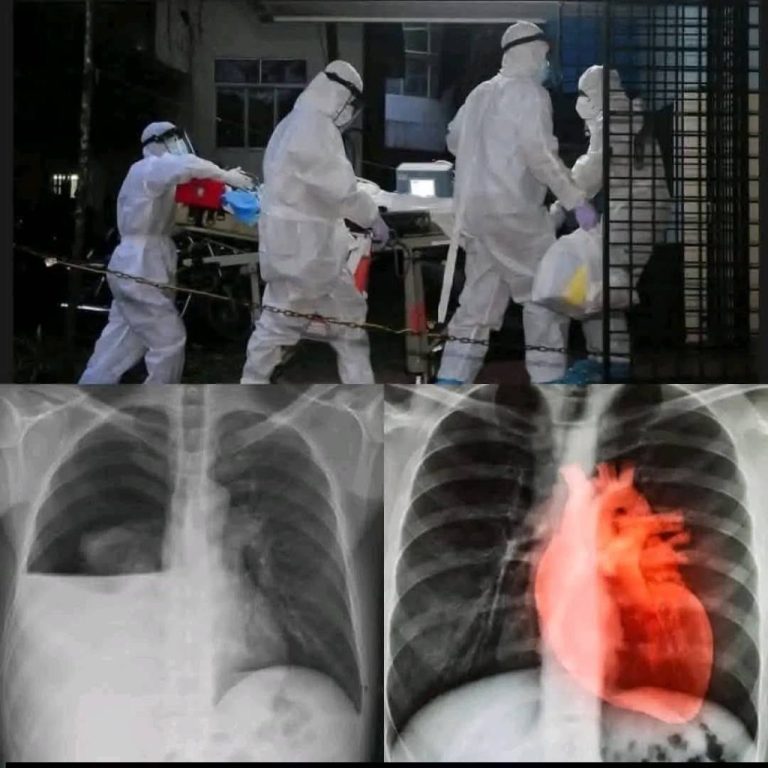 COVID-19-vaccin: Vier jaar later wordt de lijst met aanhoudende antibiotica steeds langer.