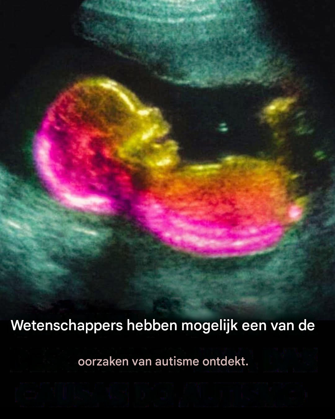Is het waar dat autisme gedeeltelijk in de baarmoeder ontstaat?