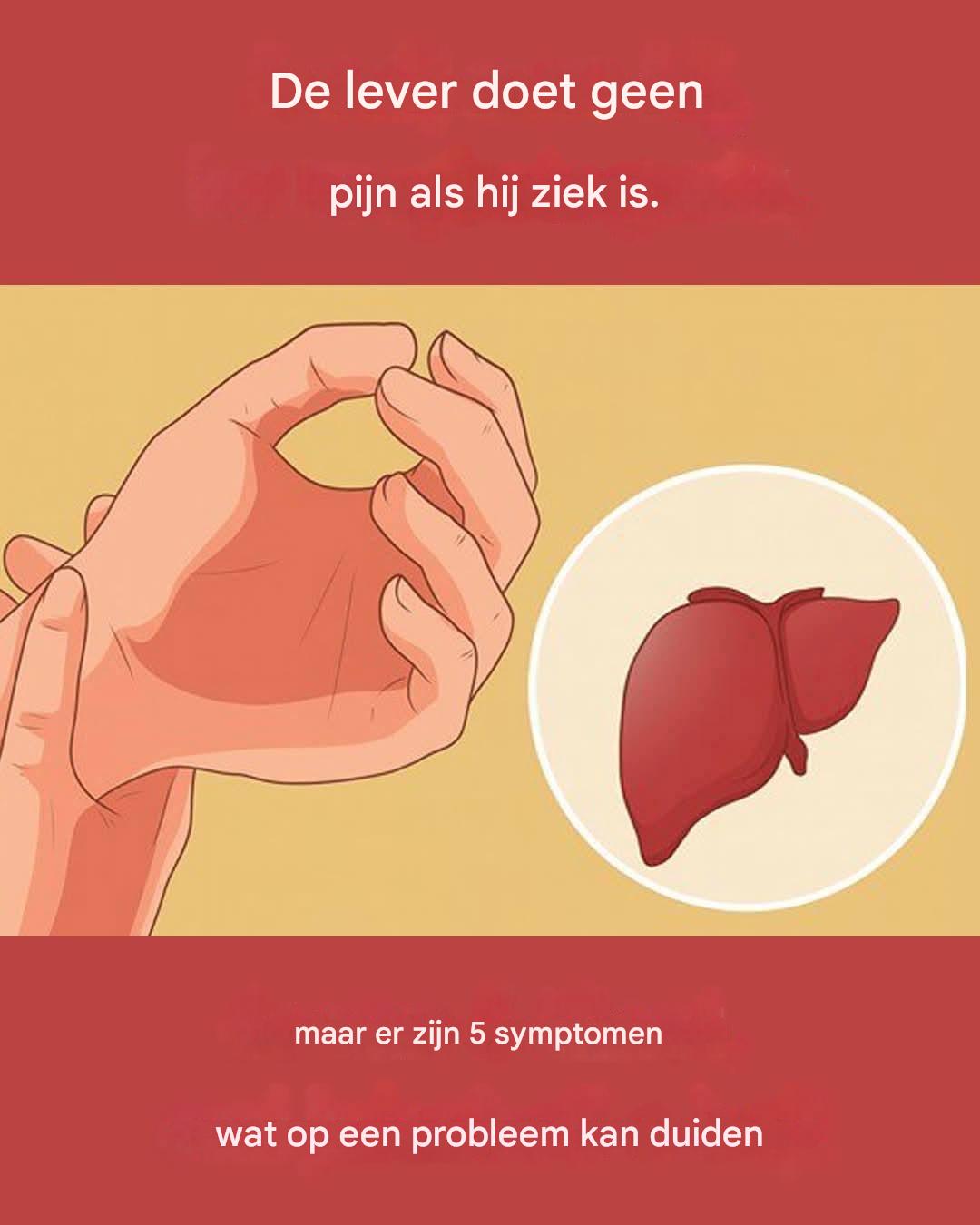 Een zieke lever veroorzaakt geen pijn, maar er zijn 5 symptomen die kunnen wijzen op een leverprobleem.