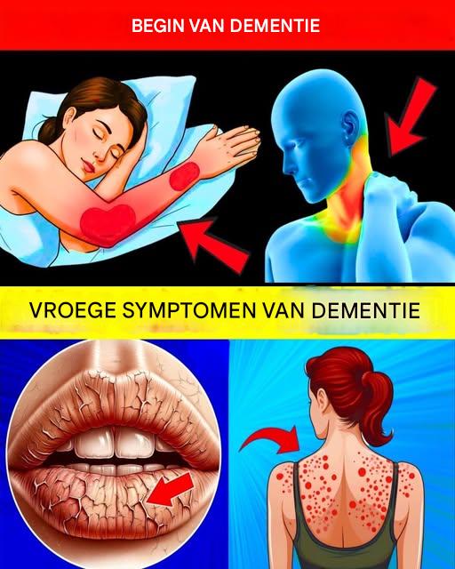 10 vroege tekenen van dementie die u NOOIT mag verstelbare!
