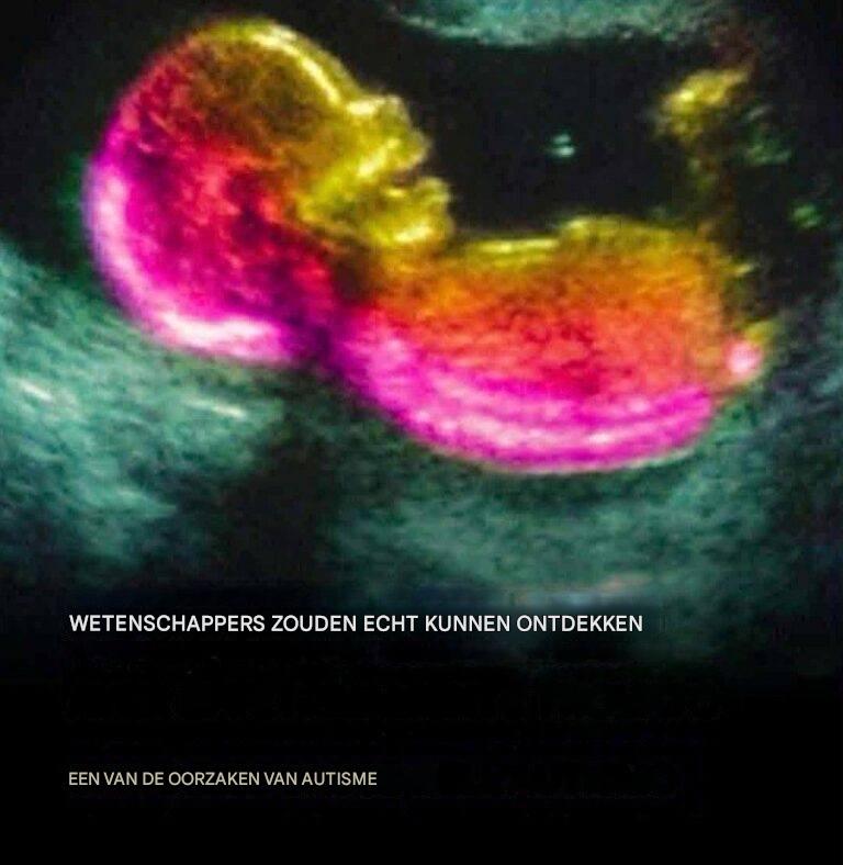 Wetenschappers hebben mogelijk een van de oorzaken van autisme ontdekt.
