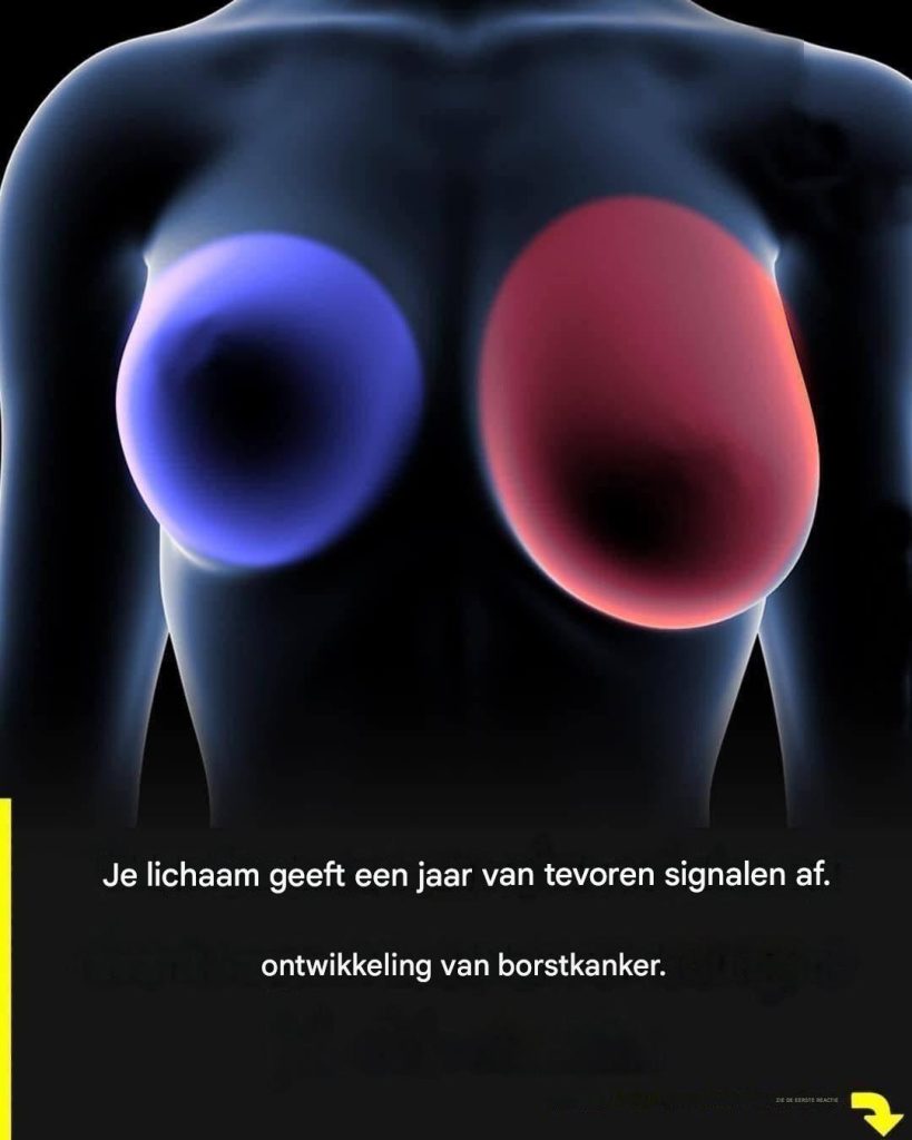 Borstkanker: 4 vroege symptomen die elke vrouw moet kennen.
