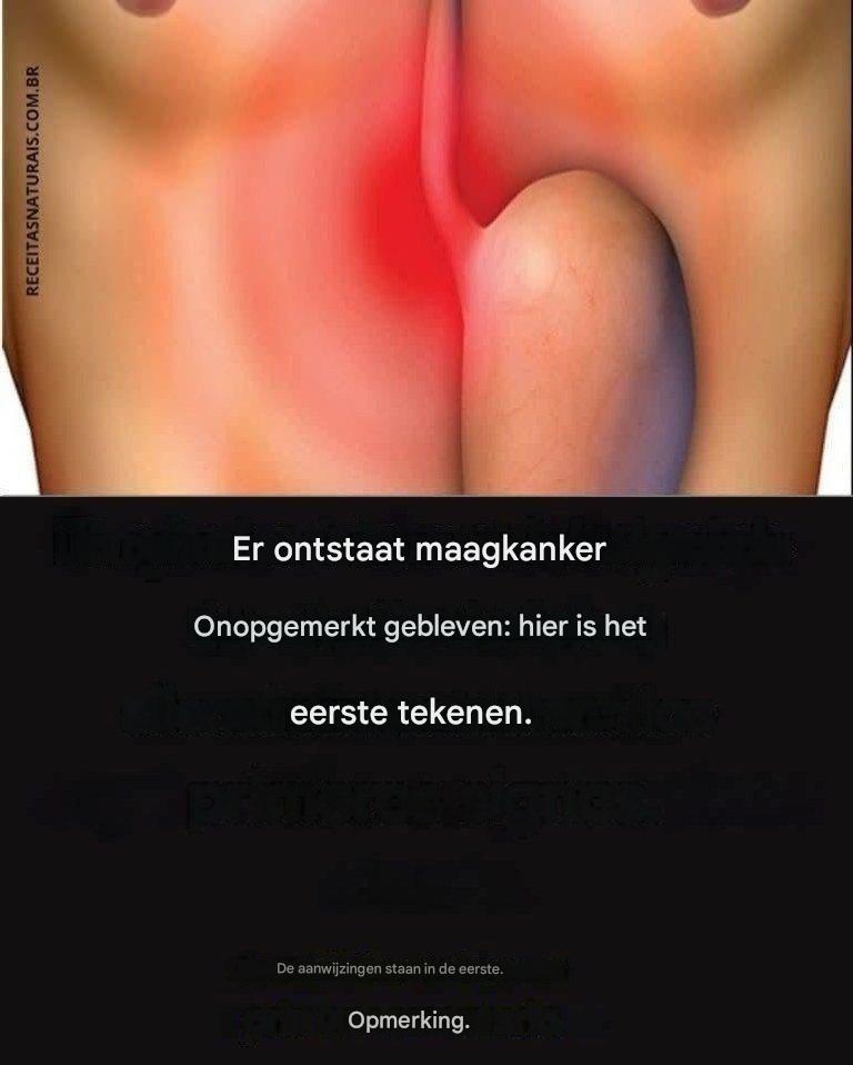 Maagkanker ontwikkelt zich ongemerkt: dit zijn de eerste symptomen