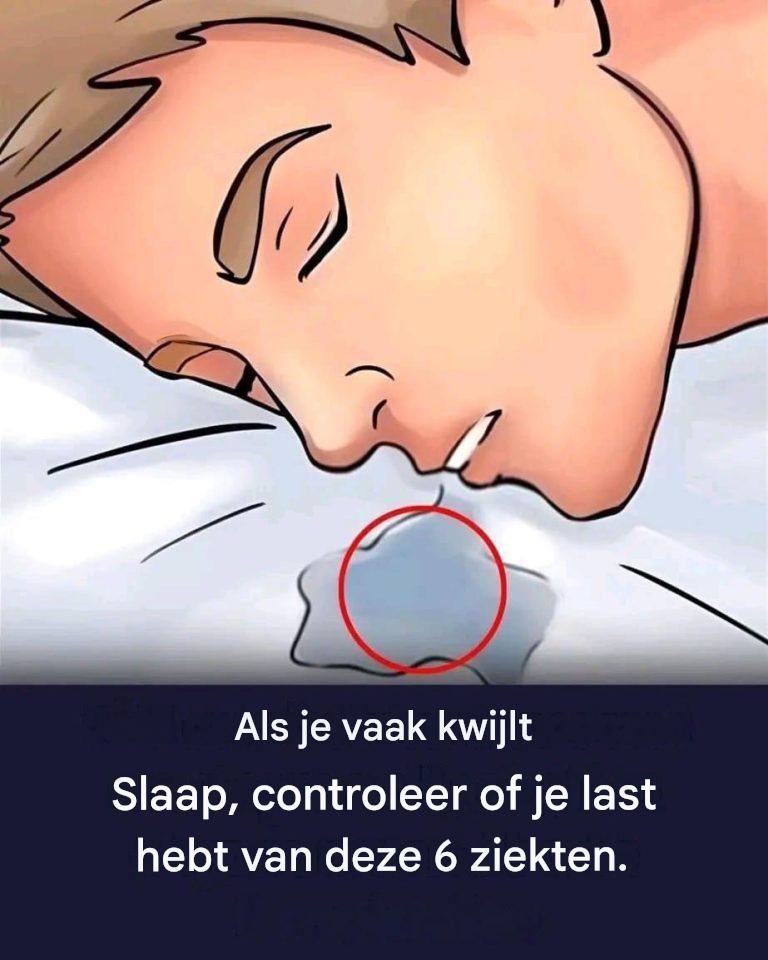 Als je vaak kwijlt tijdens het slapen, probeer dan deze 6 tips.