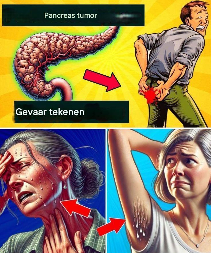 8 schokkende symptomen van alvleesklierkanker die u niet mag vertragen