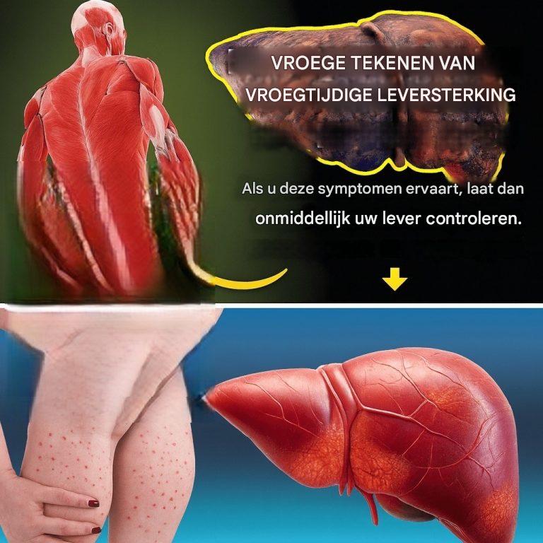 Denk je dat je in goede gezondheid verkeert? Maar je lever denkt daar misschien anders over… Negeer deze 12 verborgen waarschuwingssignalen niet!