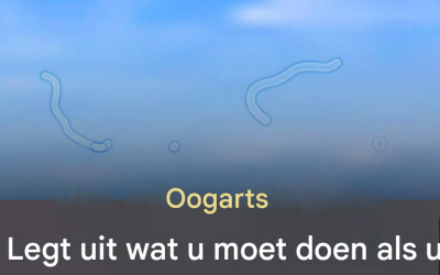Glasvochtvlokken: wat ze zijn en hoe te reageren als u ze opmerkt.