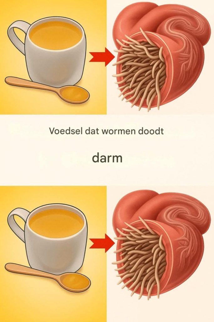 7 ingrediënten die darmwormen doden