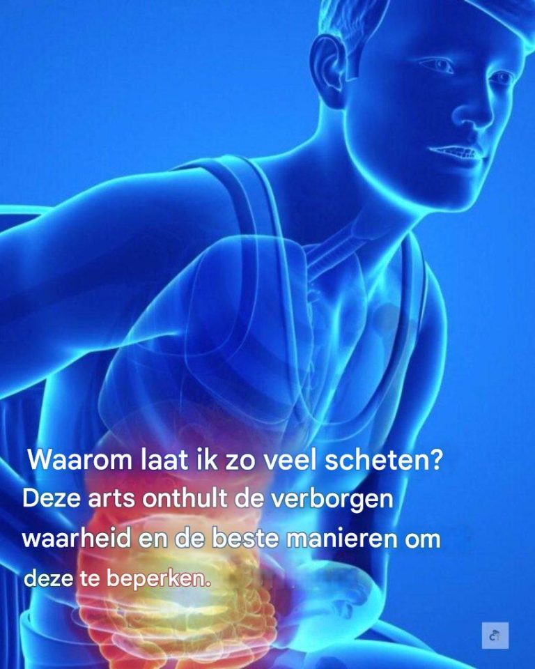 Waarom ik zoveel schema’s laat: veelvoorkomende oorzaken en eenvoudige oplossingen