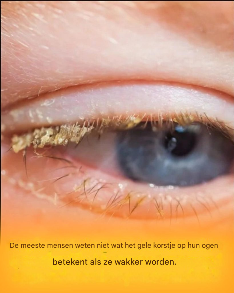 Gele korst na het wakker worden: wat betekent dat?
